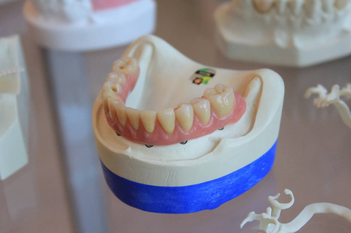 A finished denture on its working model, inspected at the bench before it ships